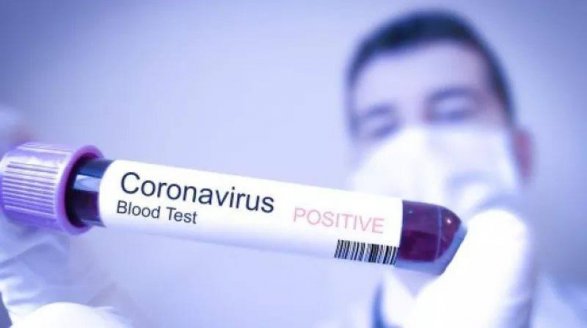 В Иране священнослужитель пытался исцелить от коронавируса 
