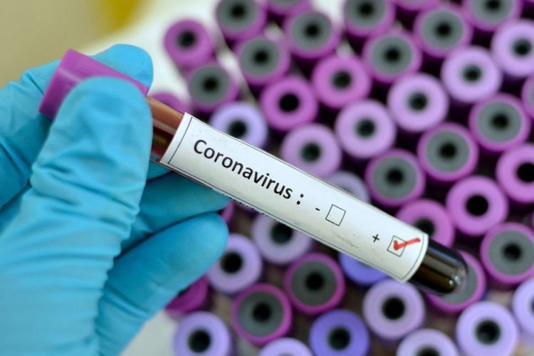 Koronavirus toxunduğumuz hər şeydən keçə bilər - VİDEO