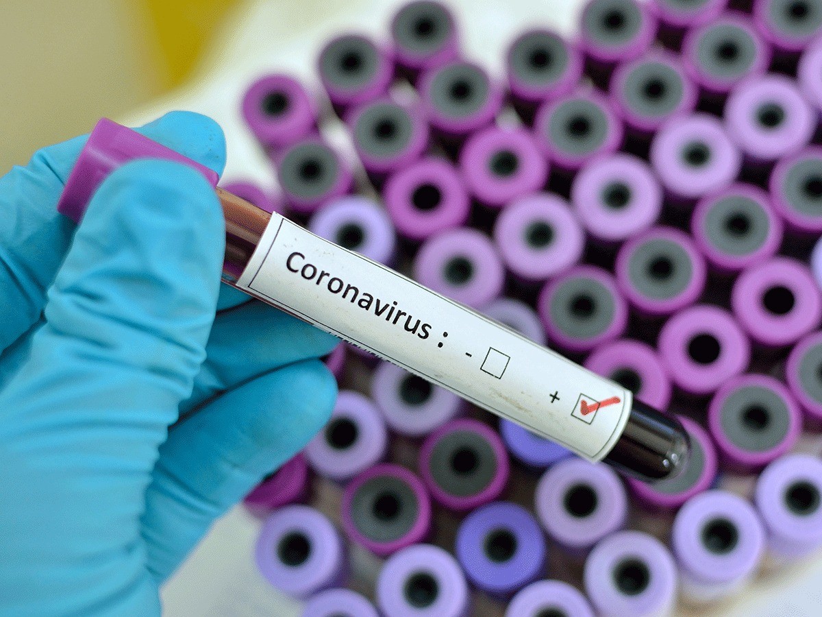 В Грузии число инфицированных коронавирусом достигло 77 человек