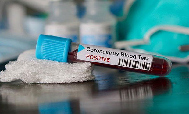 Koronavirusun daha bir simptomu aşkarlandı