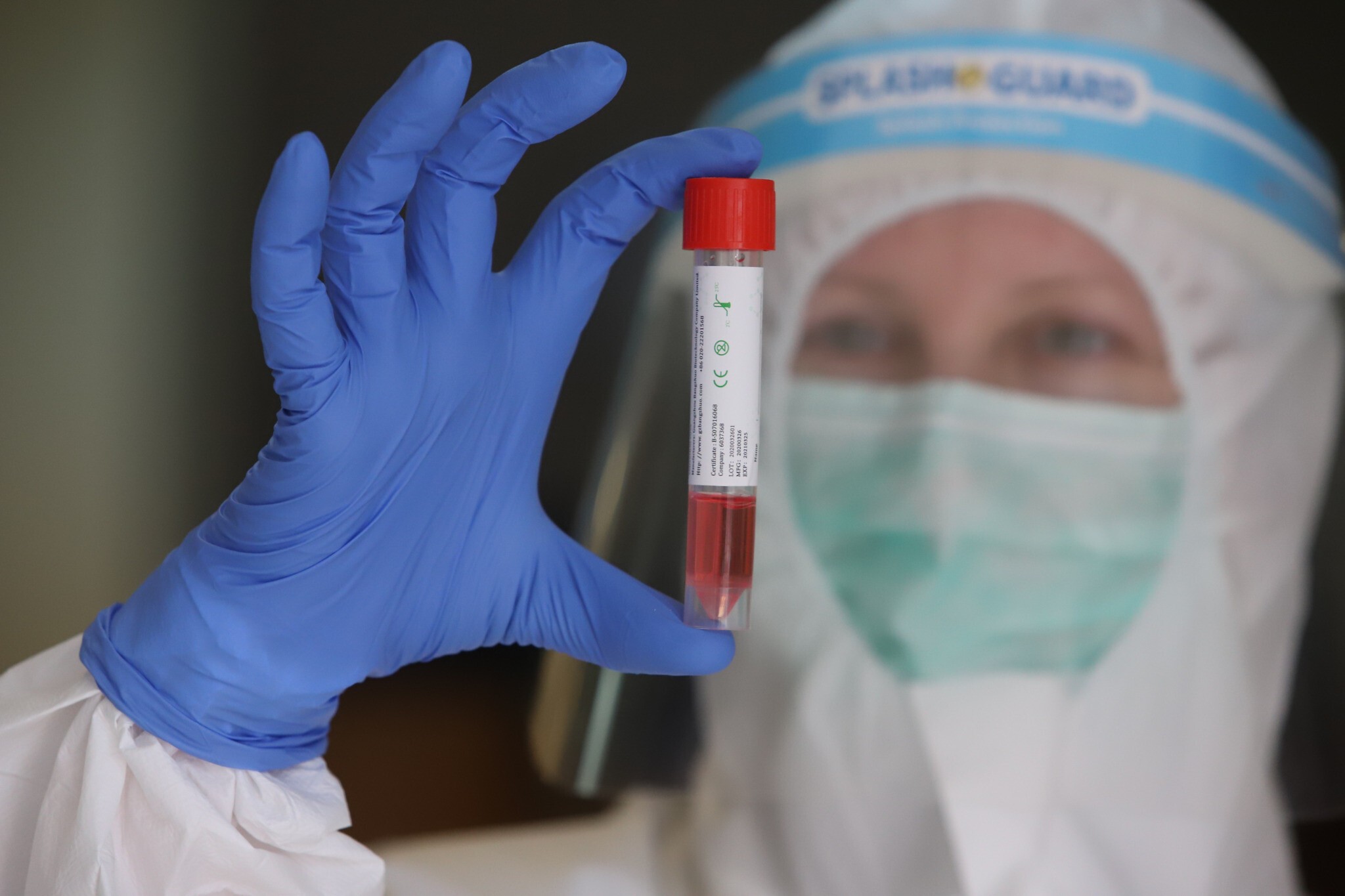 В Азербайджане 65 новых случаев заражения коронавирусом
