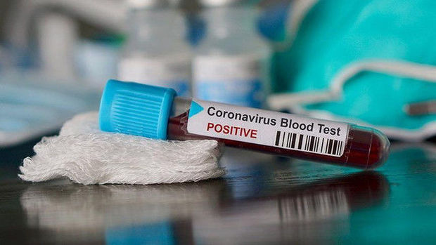 Azərbaycanda daha 44 nəfər koronavirusdan sağaldı - RƏSMİ
