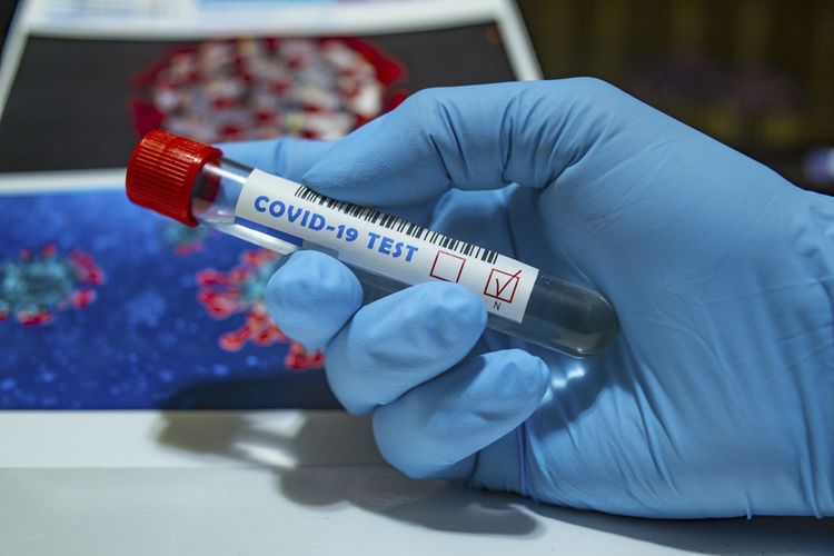 Azərbaycanda daha 106 nəfərdə koronavirus aşkarlandı