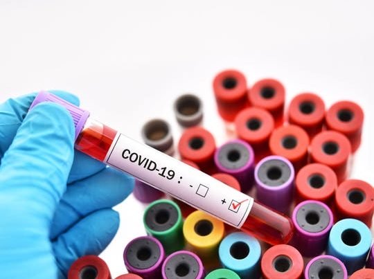 SON DƏQİQƏ: Jurnalistin ailəsində koronavirus aşkarlandı