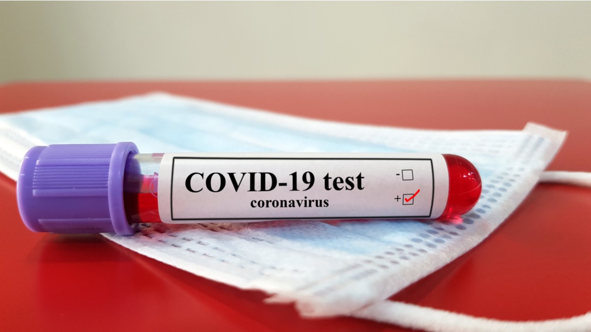 Количество проведенных в Азербайджане тестов на коронавирус превысило 350 тыс.
