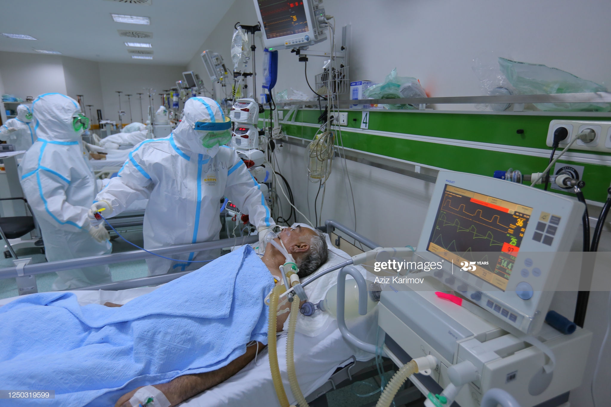 Новый антирекорд в Азербайджане: 471 заболевший коронавирусом за сутки