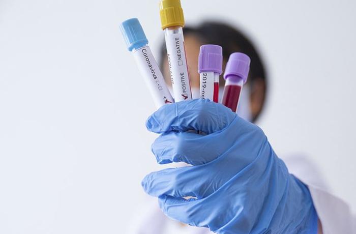 Azərbaycanda klinikaların koronavirus testi müayinələrini dayandırdıqları xəbəri yayılıb