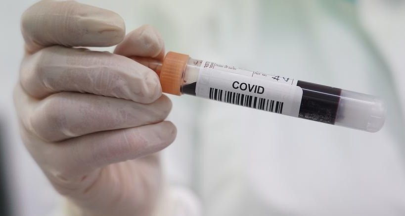 В США число заражений коронавирусом превысило 2,5 млн.