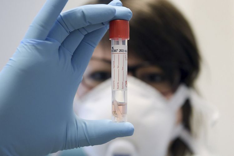 İranda son sutkada koronavirusdan 162 nəfər vəfat etdi