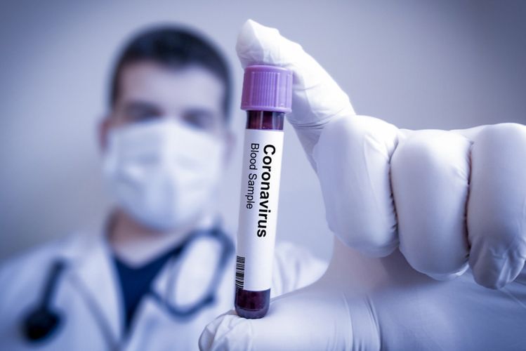 Son sutkada koronavirusa 815 yoluxma qeydə alındı, 25 nəfər öldü