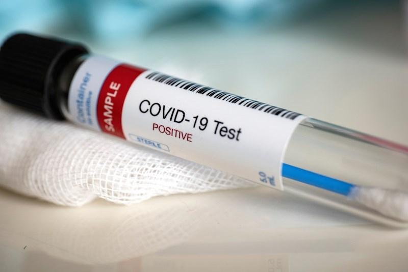 В Японии число заразившихся COVID-19 превысило 20 тысяч