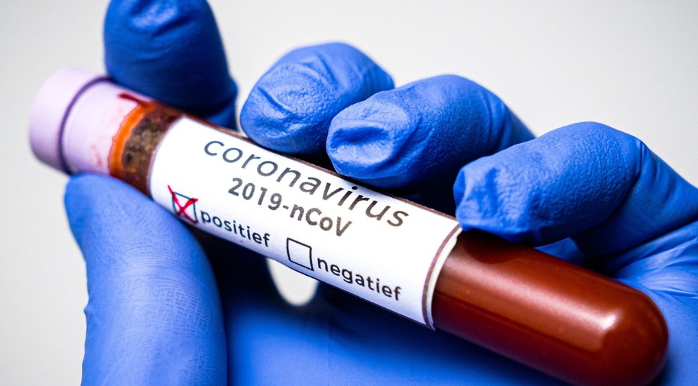 İranda 8 264 nəfər koronavirusun qurbanı olub