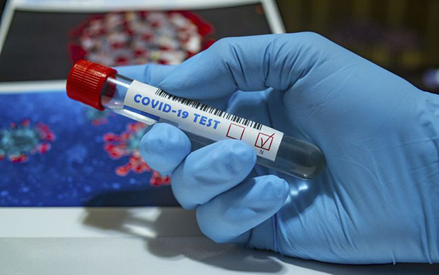 В Азербайджане 1 428 новых случаев заражения коронавирусом