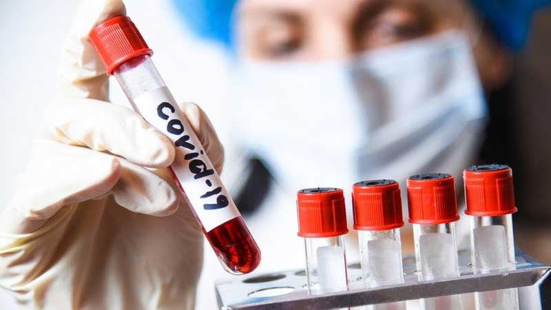 Gürcüstanda koronavirusun yeni ştammı aşkarlandı