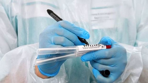 В Азербайджане за минувшие сутки выявлены еще 1 333 новых случая инфицирования коронавирусом