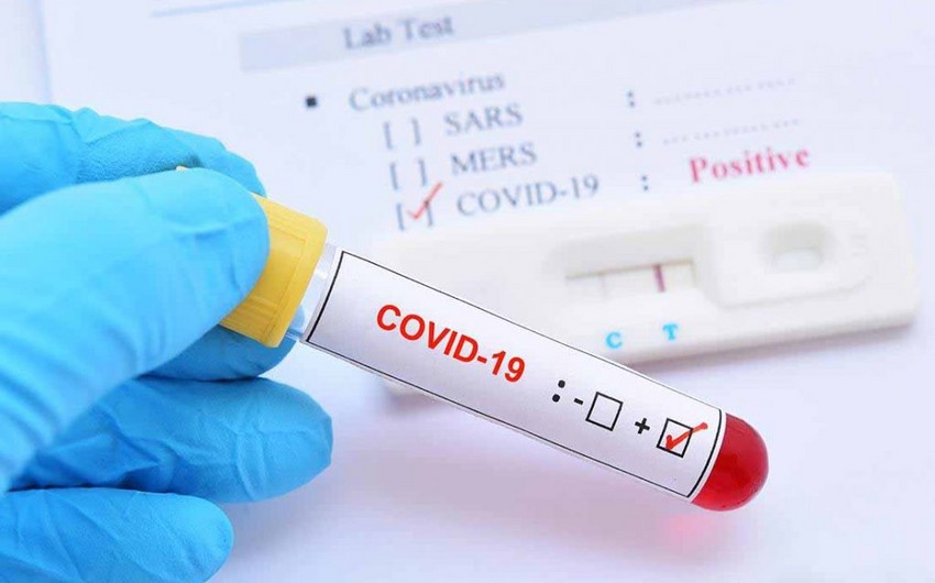 За последние сутки объявлено количество зараженных коронавирусом