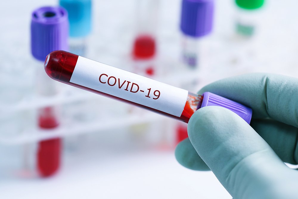 В Азербайджане за минувшие сутки выявлены 32 новых случая инфицирования коронавирусом 