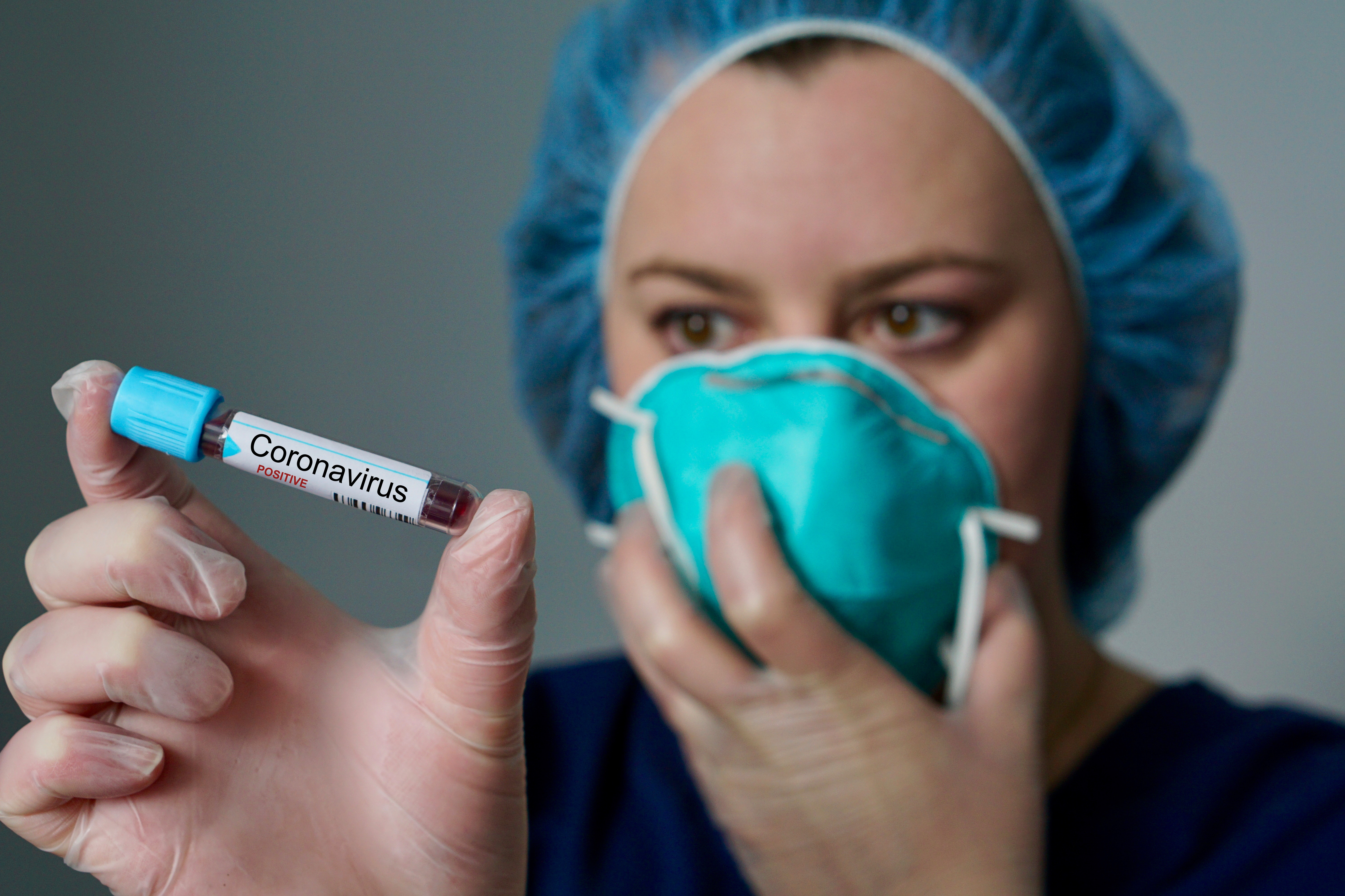 В Азербайджане за минувшие сутки выявлены 75 новых случаев инфицирования коронавирусом