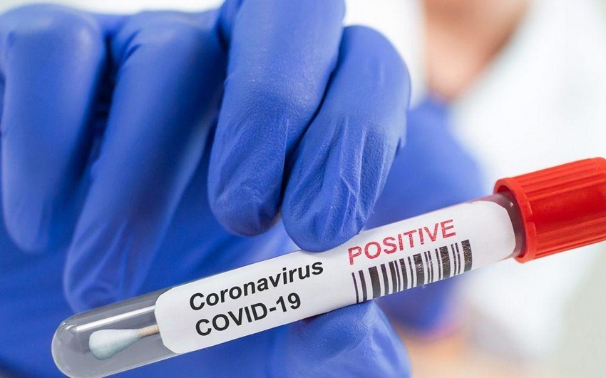 В Азербайджане за сутки коронавирусом заразились 1 997 человек