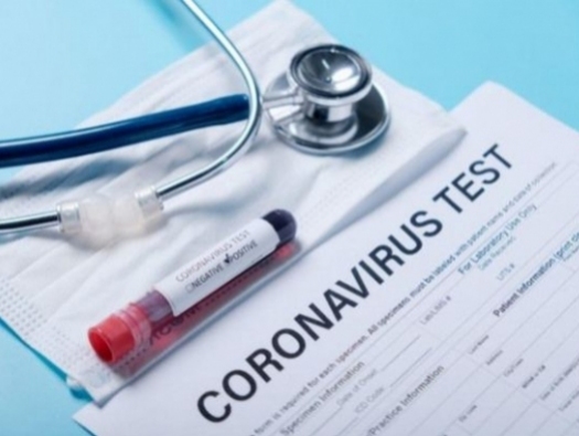 В Азербайджане за сутки выявлено 11 случаев заражения коронавирусом