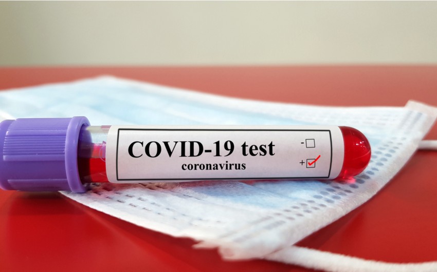 Azerbaijan confirms 155 new COVID-19 cases