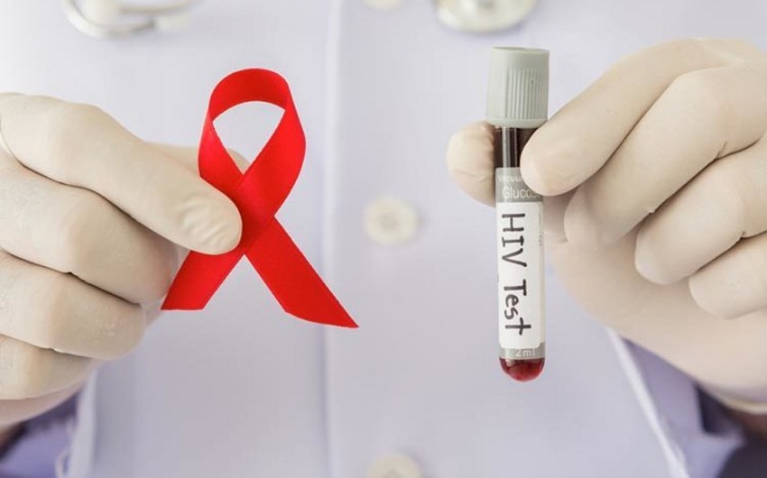 Spread of HIV localized in Azerbaijan