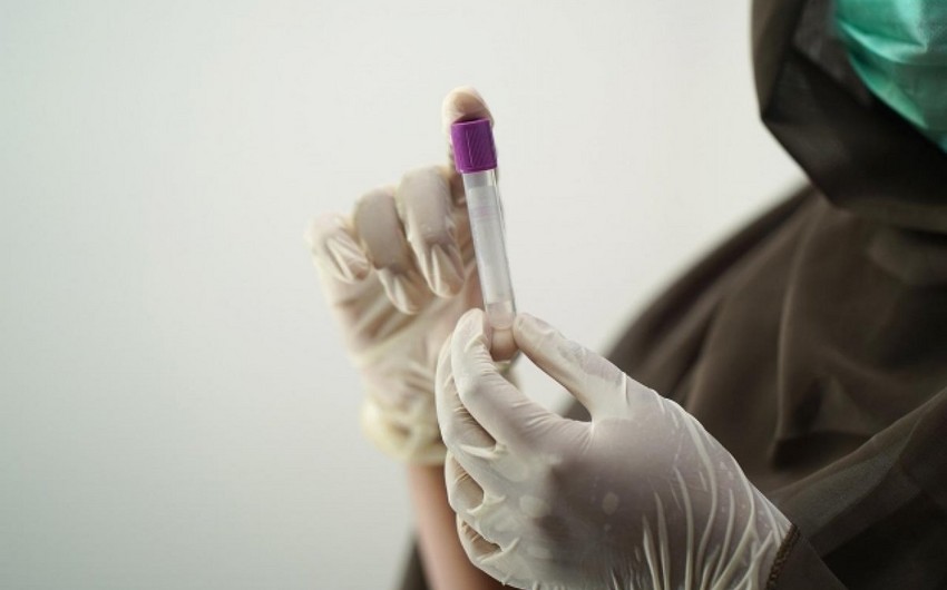 Свиной грипп обнаружили в 74 регионах России