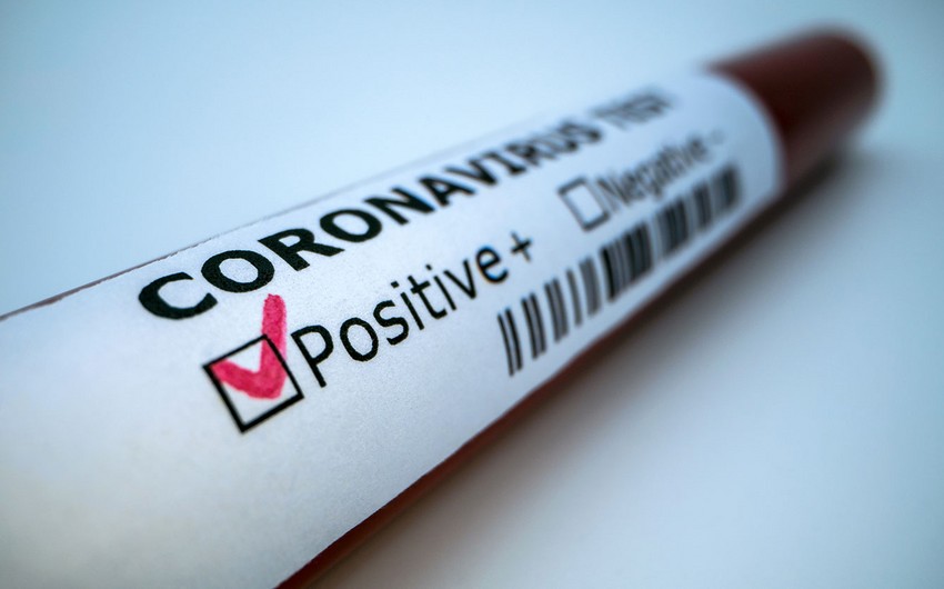 Azerbaijan reports 62 new coronavirus cases