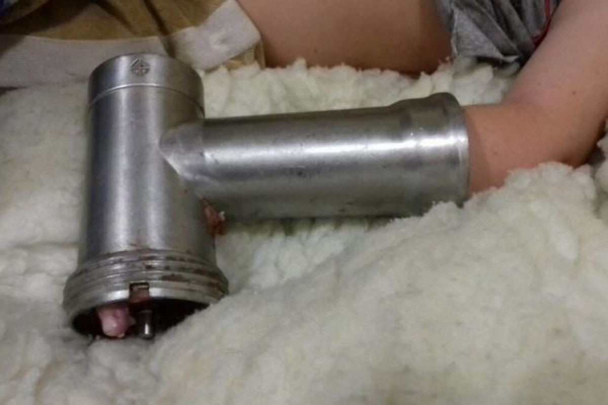 В Лянкяранском районе пальцы 13-летней девочки застряли в мясорубке
