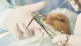 Azərbaycanda 18-19 yaşlı qadınlar arasında abortların sayı 19% artıb