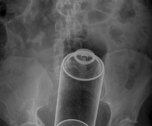 Most unusual X-rays