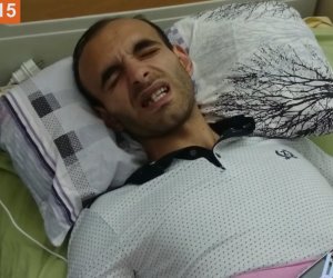 Журналист Расим Алиев скончался от полученных травм