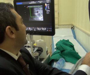 Həkim məsləhəti: Varikozun müalicəsi - ANN.TV