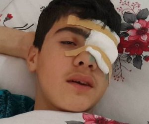  Bakıda 10-cu sinif şagirdi gözündən güllələndi – FOTO