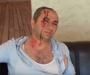 Abşeronda döyülən əlil evini yandırdı – VİDEO