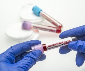 В Азербайджане выявлено 158 новых случаев инфицирования COVID-19