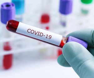 В Азербайджане за минувшие сутки выявлены 32 новых случая инфицирования коронавирусом 