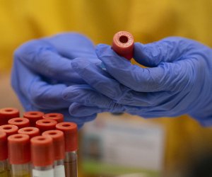 В Азербайджане за последние сутки коронавирусом заразились 1 017 человек