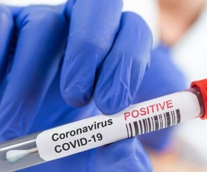 Azerbaijan reports 6,620 new COVID-19 cases on February 2