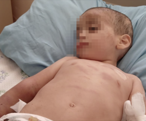 Ağdamda iki yaşlı uşaq döyülüb