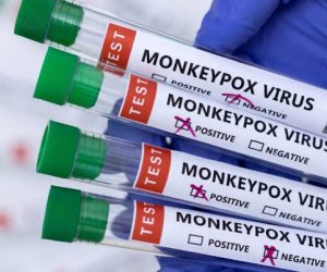 ÜST-dən meymunçiçəyi ilə bağlı - Xəbərdarlıq ÜST-dən meymunçiçəyi ilə bağlı - Xəbərdarlıq