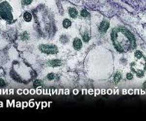 Efiopiyada təhlükəli virusun yayıldığı təsdiqlənib