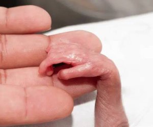 Xəstəxanın ərazisində ağacın altında 34-36 həftəlik ölü döl tapılıb