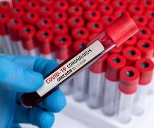 Son bir ayda dünya üzrə COVID19-dan ölüm sayı azalıb - ÜST