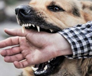 Bakının bu qəsəbəsində 1 ay ərzində 65 nəfəri it dişləyib