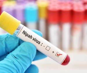 Nipah и глобальная уязвимость: может ли риск дойти до Азербайджана?
