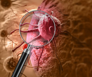 В Австралии начнутся испытания первой в мире вакцины от рака для детей