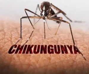 Ermənistanda Çikunqunya qızdırması halı qeydə alınıb