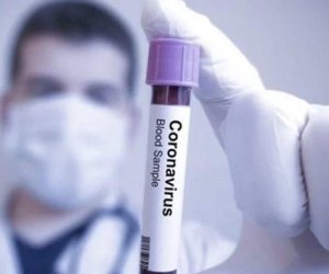Koronavirusun yeni ştampı aşkar edilib
