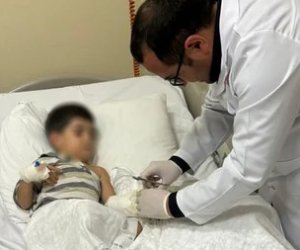 3 yaşlı uşağın ət maşınında amputasiya olunan əli 8 saatlıq əməliyyatla bərpa edilib